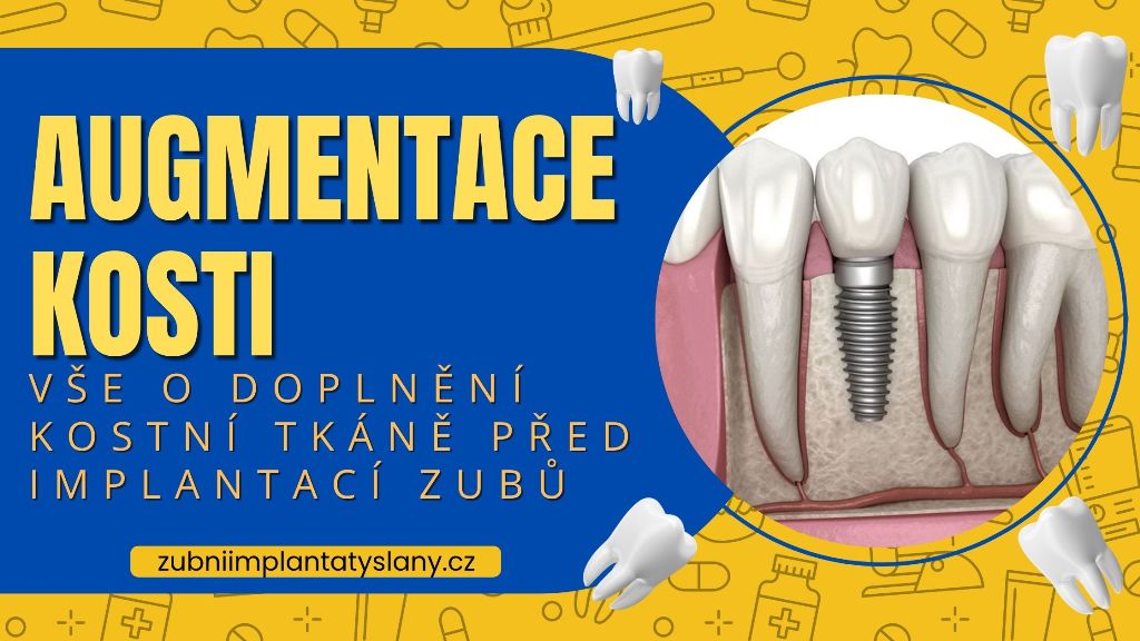 Augmentace kosti_ Vše o doplnění kostní tkáně před implantací zubů