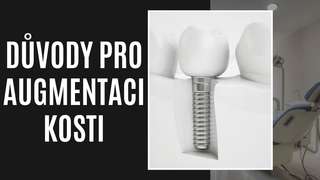 Důvody Pro Augmentaci Kosti