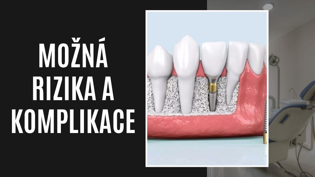 Možná Rizika a Komplikace
