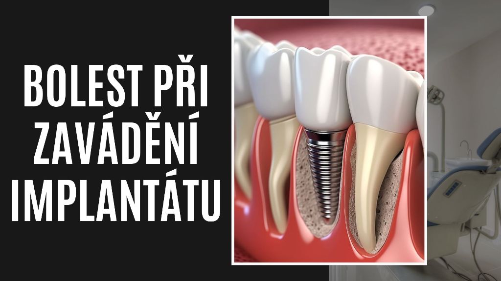 Bolest Při Zavádění Implantátu