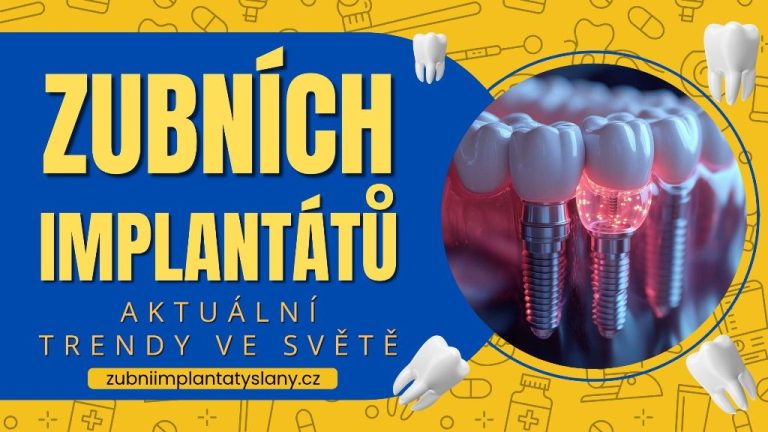Aktuální trendy ve světě zubních implantátů