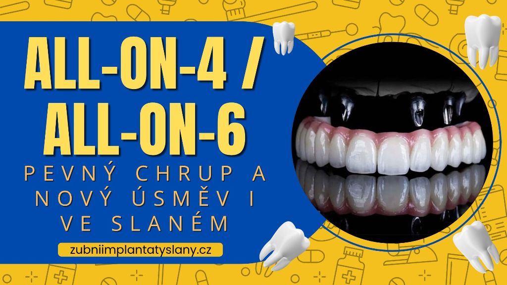 All-on-4 _ All-on-6_ Pevný chrup a nový úsměv i ve Slaném