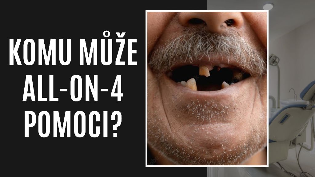 Komu může All-on-4 pomoci