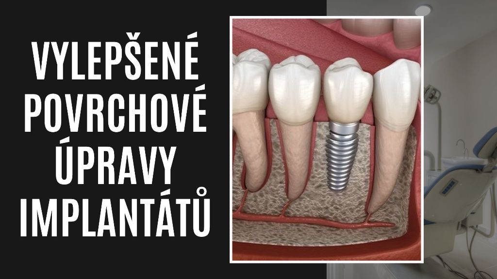 Vylepšené povrchové úpravy implantátů