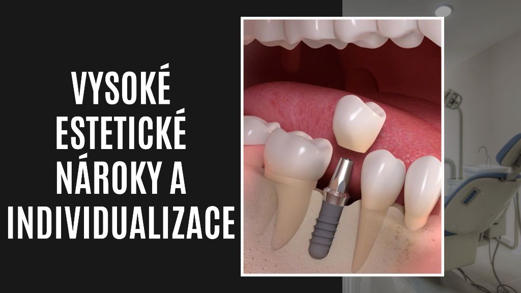 Vysoké estetické nároky a individualizace