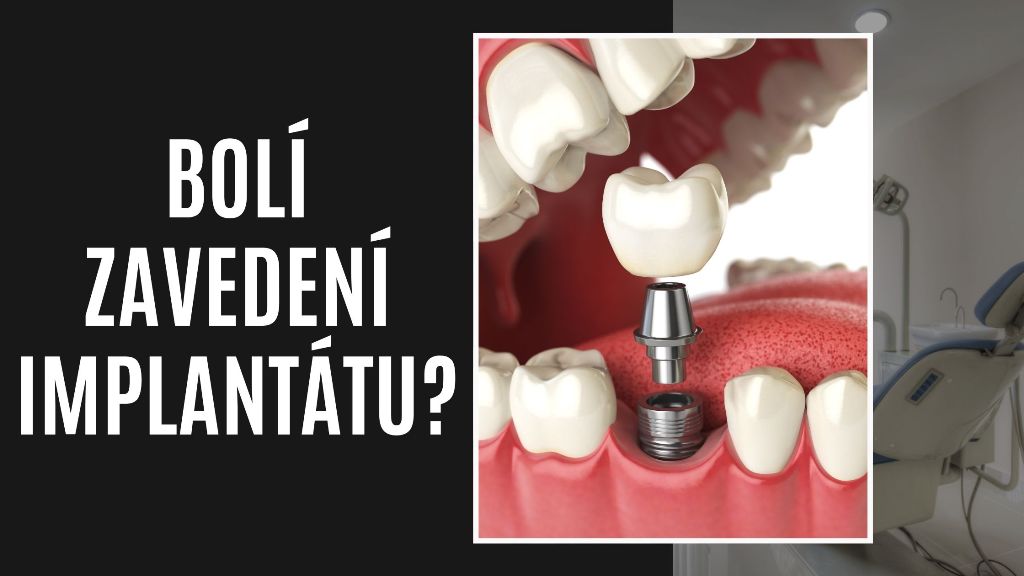 Bolí zavedení implantátu