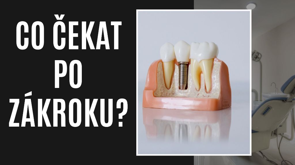 Co čekat po zákroku