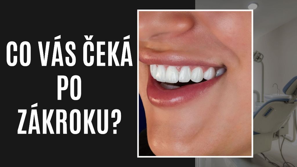 Co vás čeká po zákroku