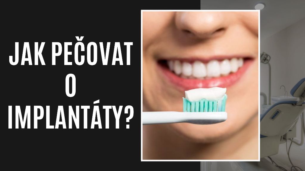 Jak pečovat o implantáty