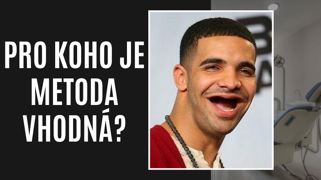 Pro koho je metoda vhodná