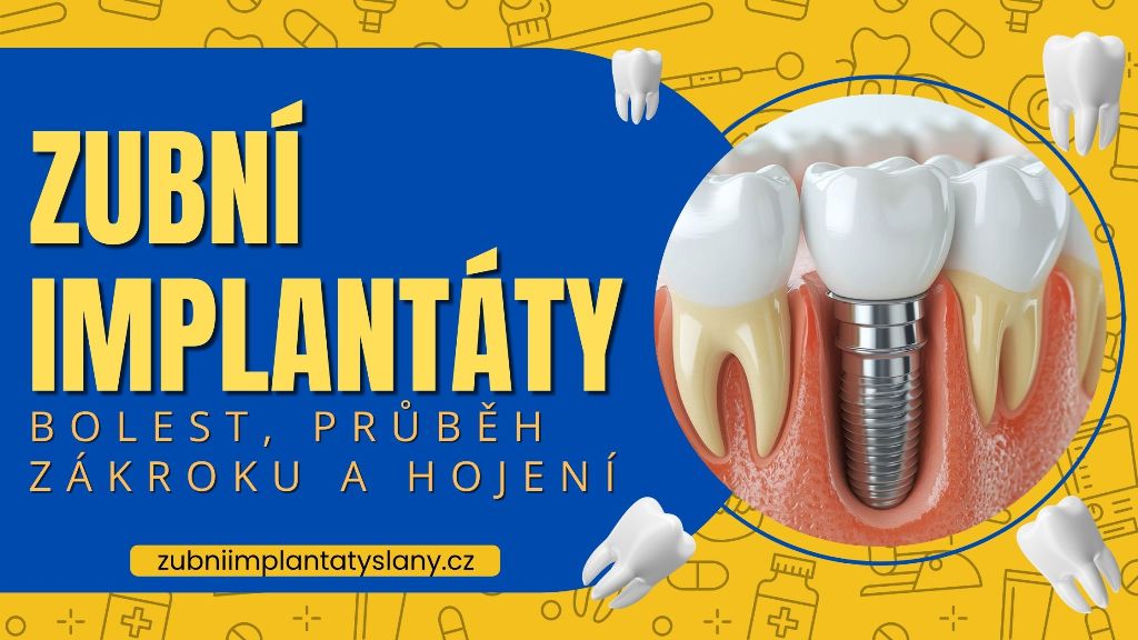 Zubní implantáty – bolest, průběh zákroku a hojení