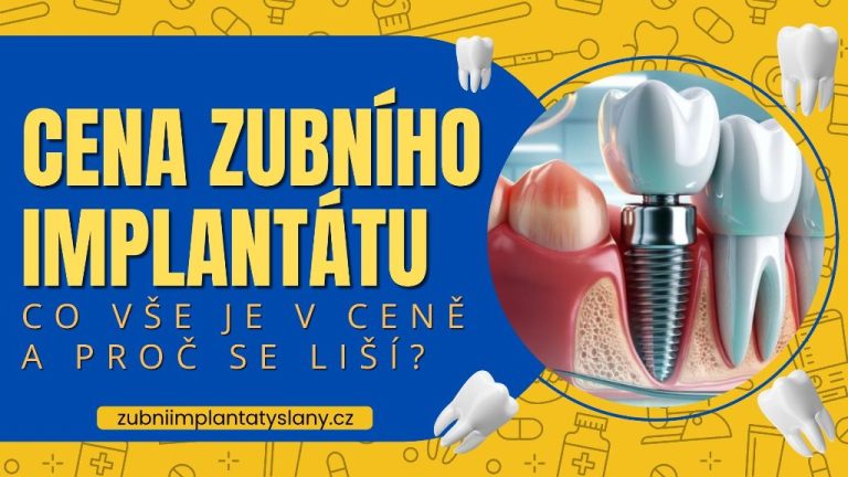 Cena zubního implantátu_ Co vše je v ceně a proč se liší