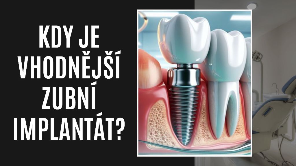 Kdy je vhodnější zubní implantát