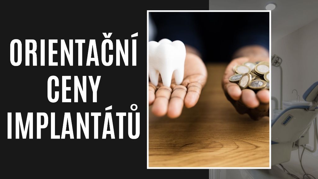 Orientační ceny implantátů